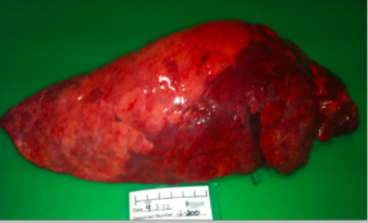 <p>Describe this lesion in a cow lung. </p>