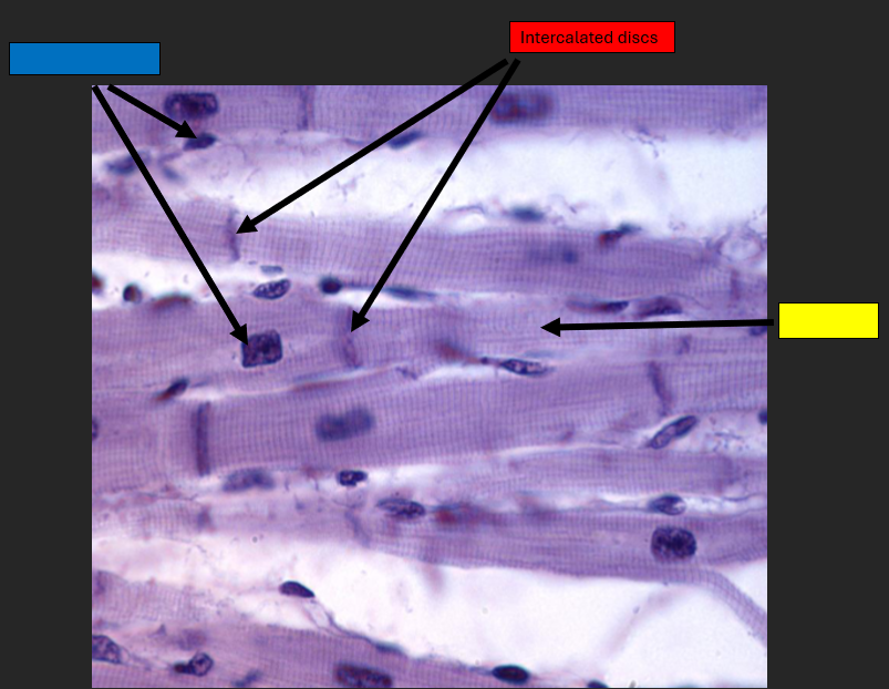 <p>Intercalated discs</p>