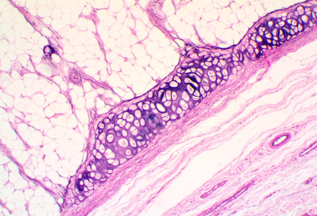 <p><span>Found in the external ear, epiglottis, and part of the larynx</span></p>