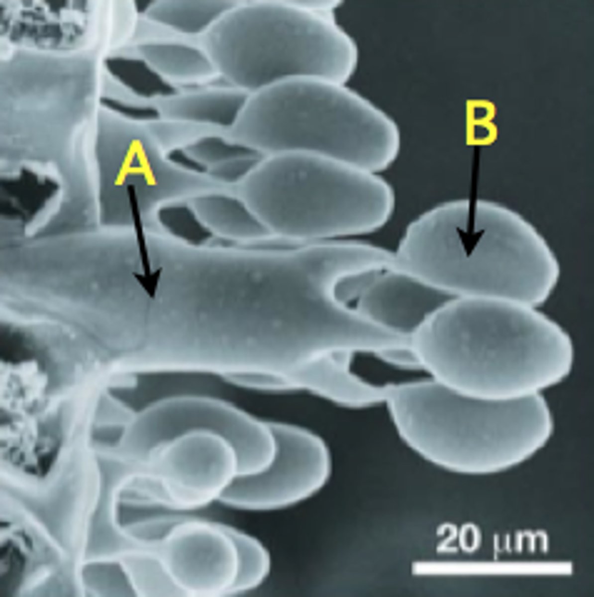 <p>Sexual fungal spores located in a club shaped structure.</p>