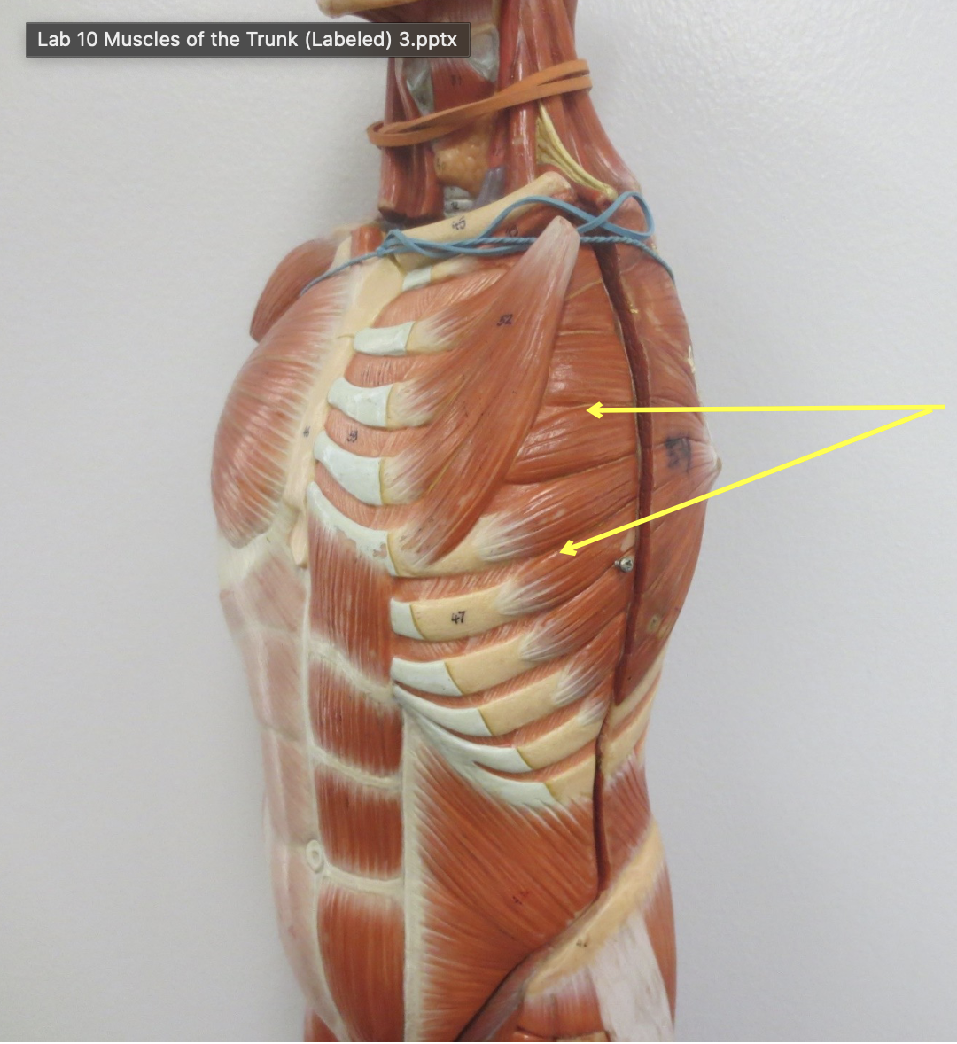 <p>Which muscle</p>