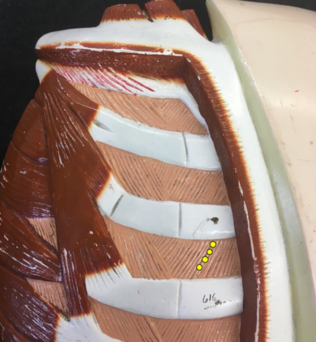<p>Striations going INwards</p>