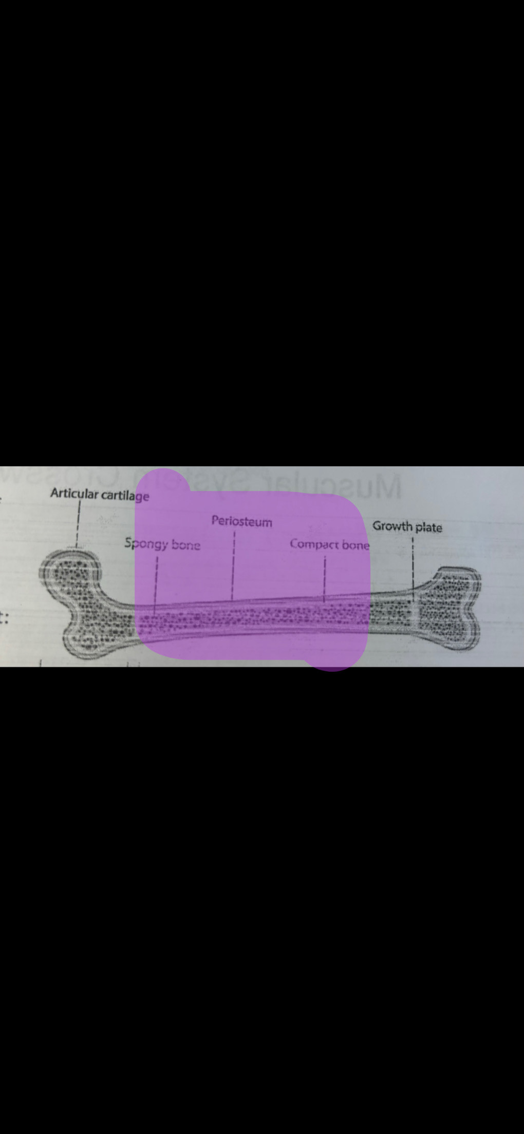 <p>Spongy bone, periosteum, and compact bone</p>