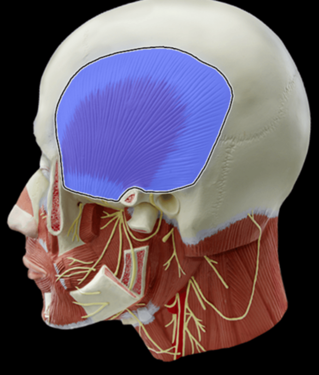 <p>What Muscle Is Highlighted?</p>