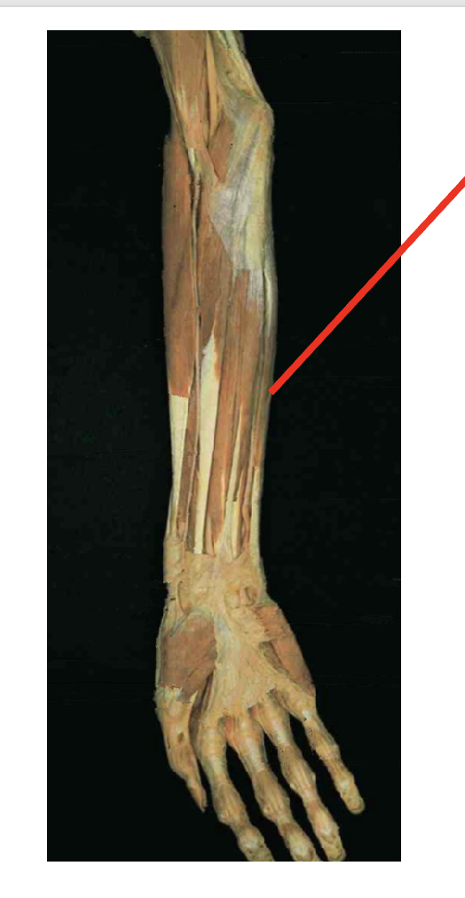 <p>What is this muscle? Where does it insert? What is its origin</p>