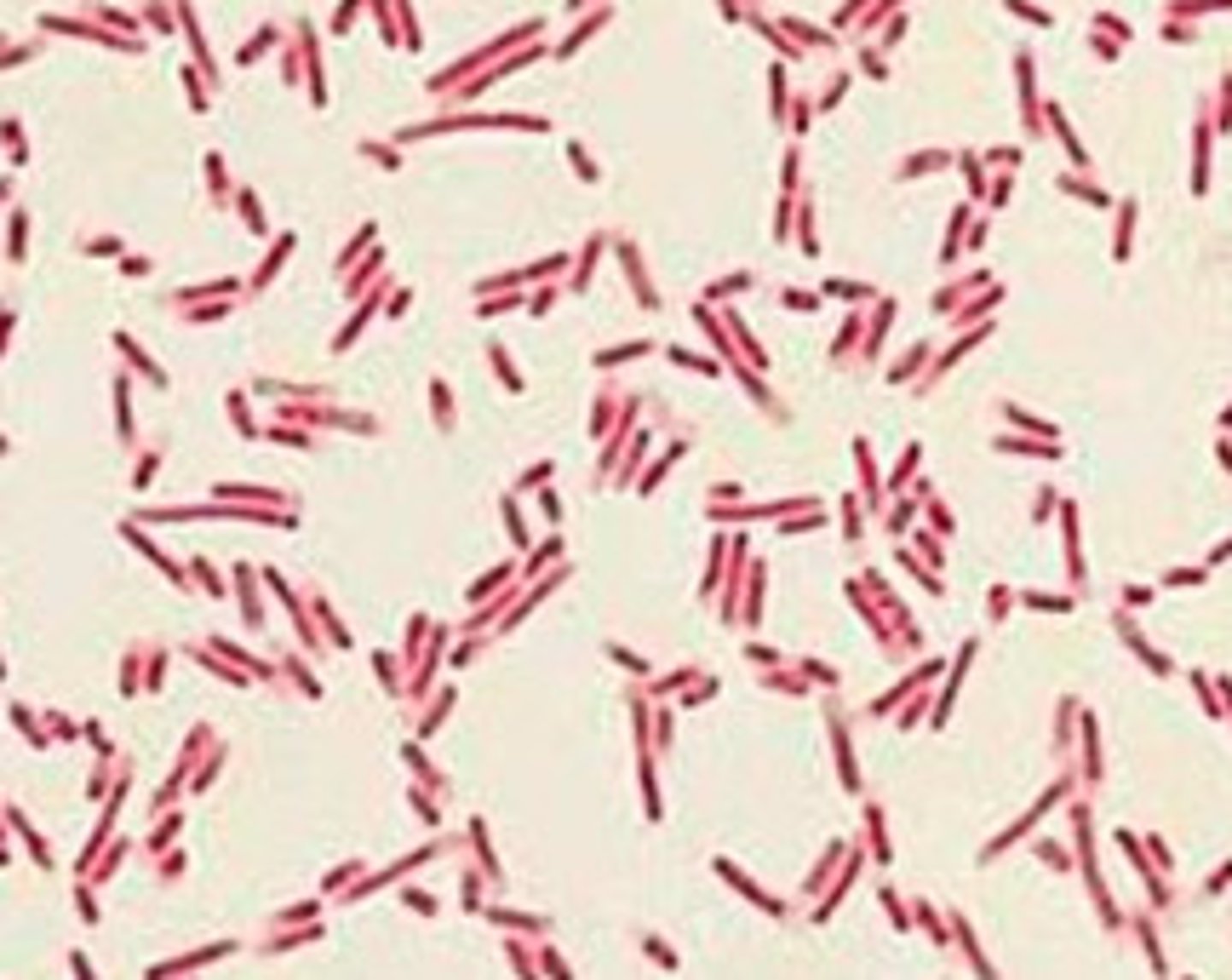 <p>1. The crystal violet turns the cell purple.</p><p>2. The iodine turns the cell a blue-purple color.</p><p>3. The alcohol wash causes the cell to lose its stain.</p><p>4. The safranin dyes the cell an orange-red (pink) color.</p>