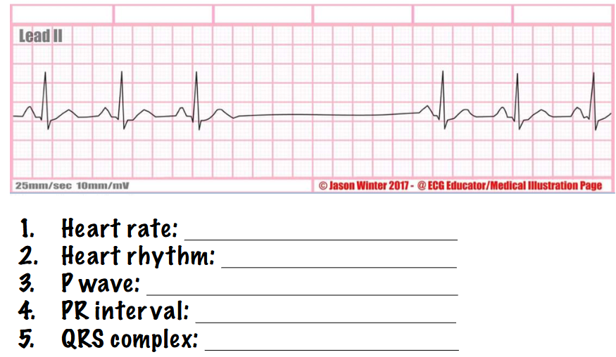 <p>what type of rhythm is this? answer the questions</p>