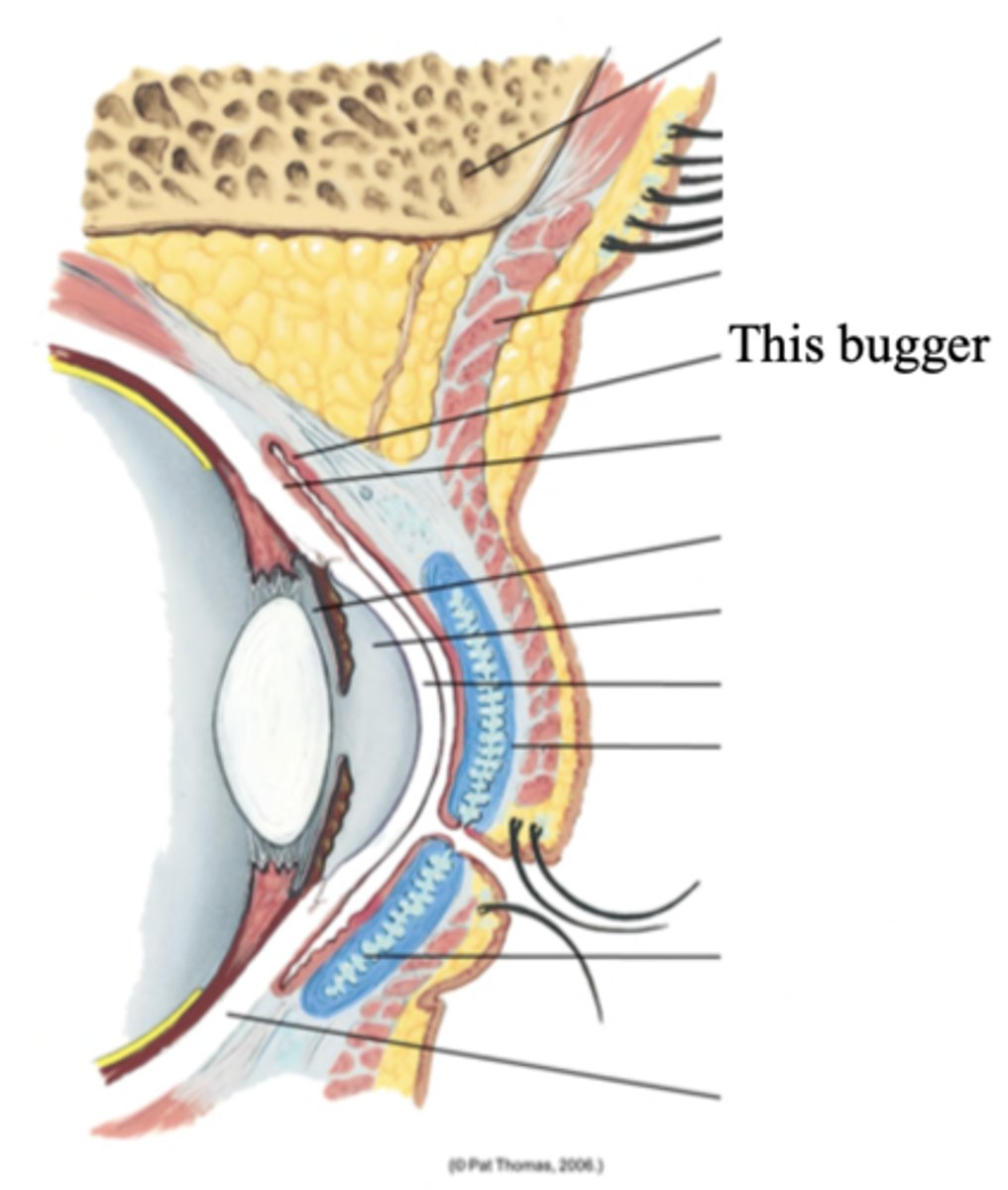 <p>The conjunctiva that lines the eyelids and is clear, with many small blood vessels</p>