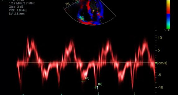 <p>what measurement is this for </p>