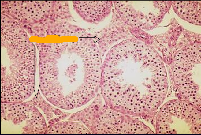 <p>Identify the structure:</p><p>Specie:</p><p>Orange:</p>