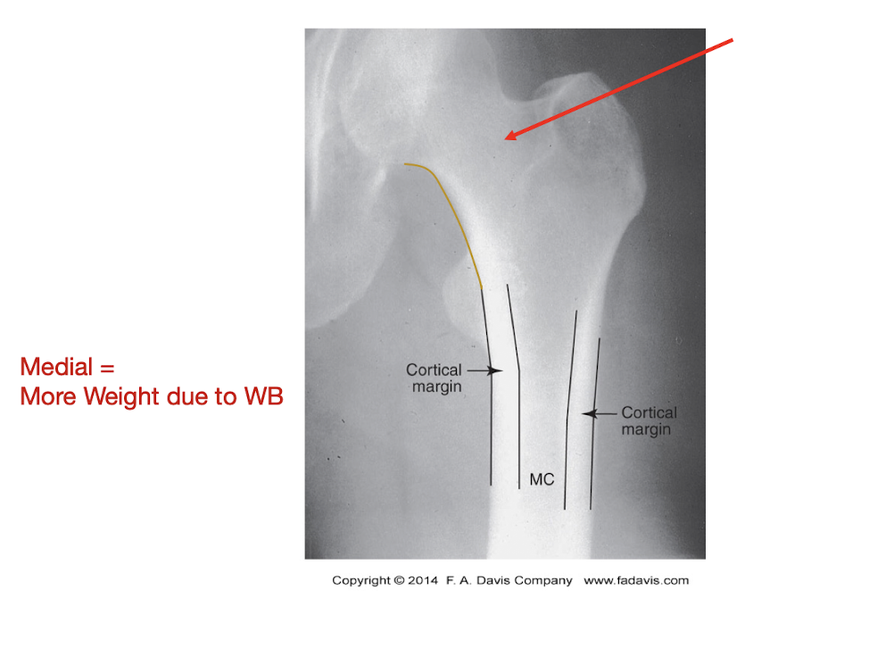 <p>B = Bone Density:</p><ul><li><p>What to look for? (Pt 1 - 2)</p></li></ul><p></p>