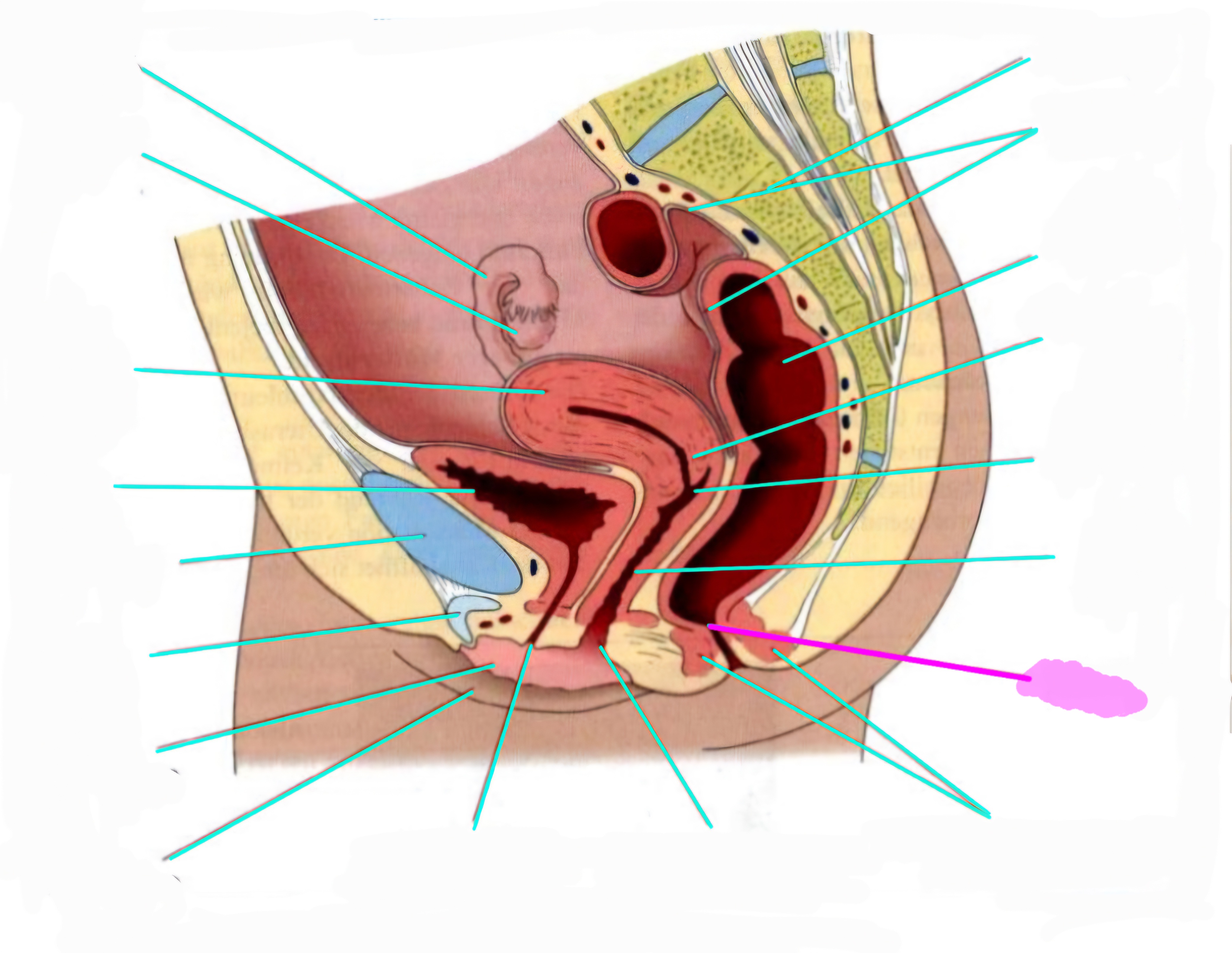term image