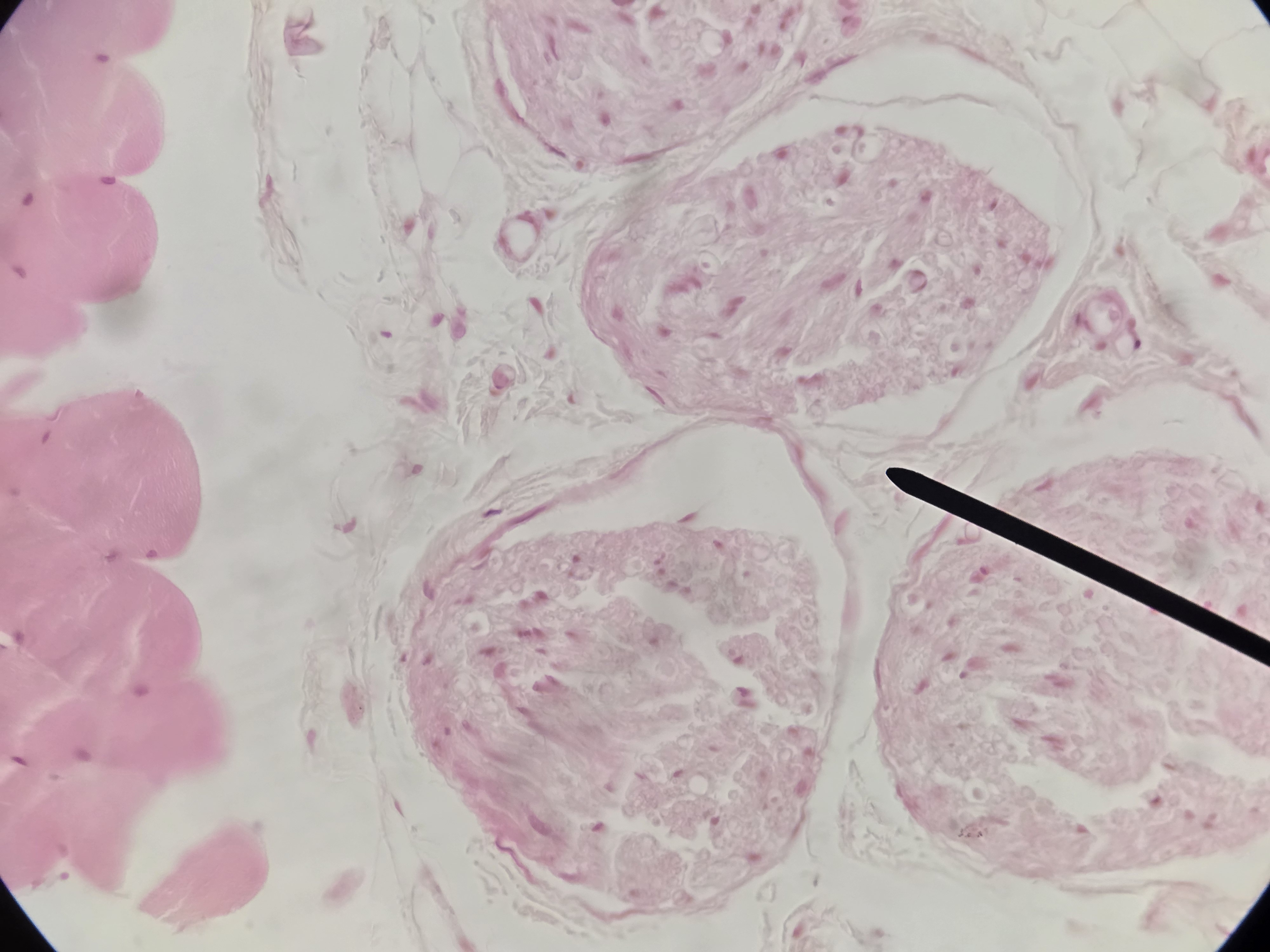 <p>Name Connective Tissue Layer</p>