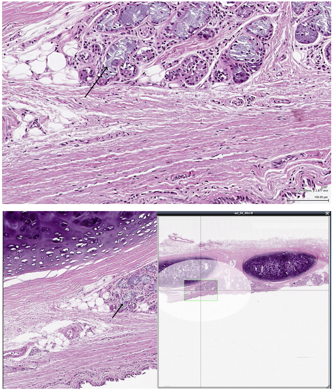 <p><span><span>The structure indicated by the arrow is most likely which of the following?</span></span></p>