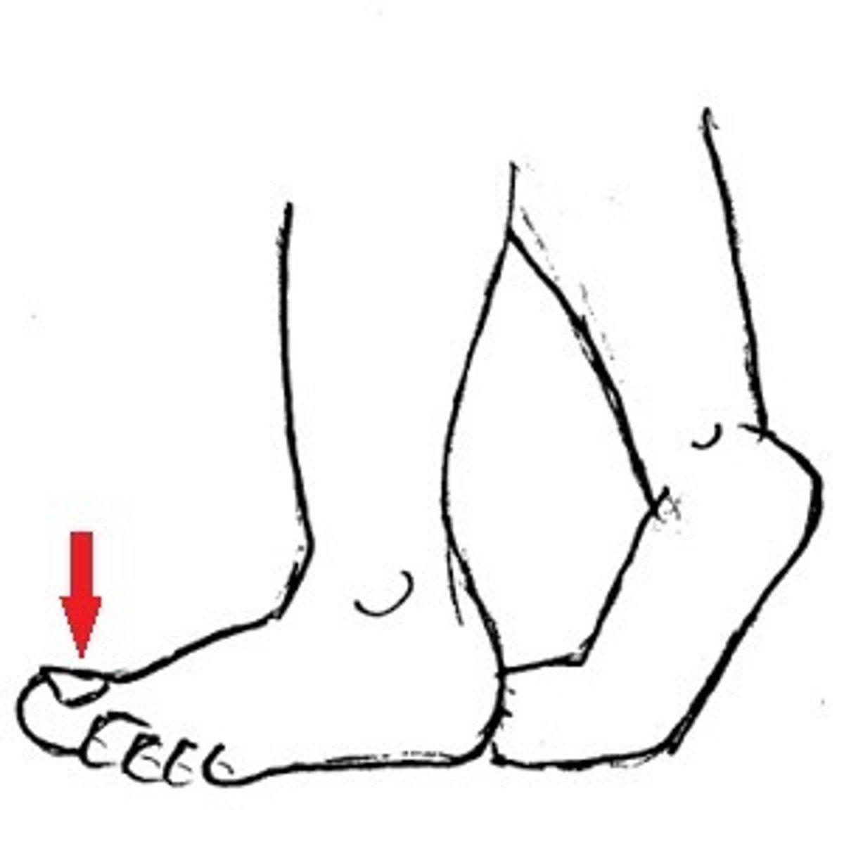 <p>big toe</p>