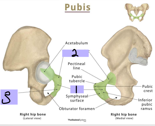 <p><strong>Pubis: __________ _____ _____ (#2)</strong></p><p>-Projects posterolateral from body</p><p>-Joins with ilium and ischium</p>