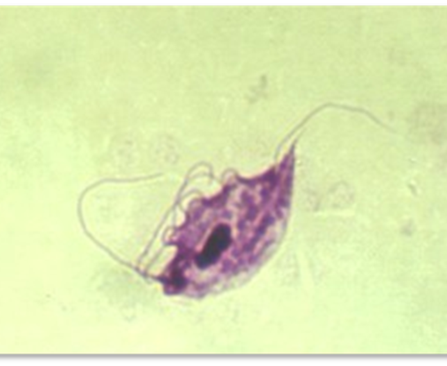 <p>Host: bovine Locations: prepuce of bulls and vagina, cervix, and uterus of cows Transmission: sexual transmission Clinical signs: abortion Diagnosis: finding the protozoan in fluid from stomach of aborted fetus, from uterine discharges, or washings of vagina and prepuce Treatment: Metronidazole Common name: Trichomonas</p>