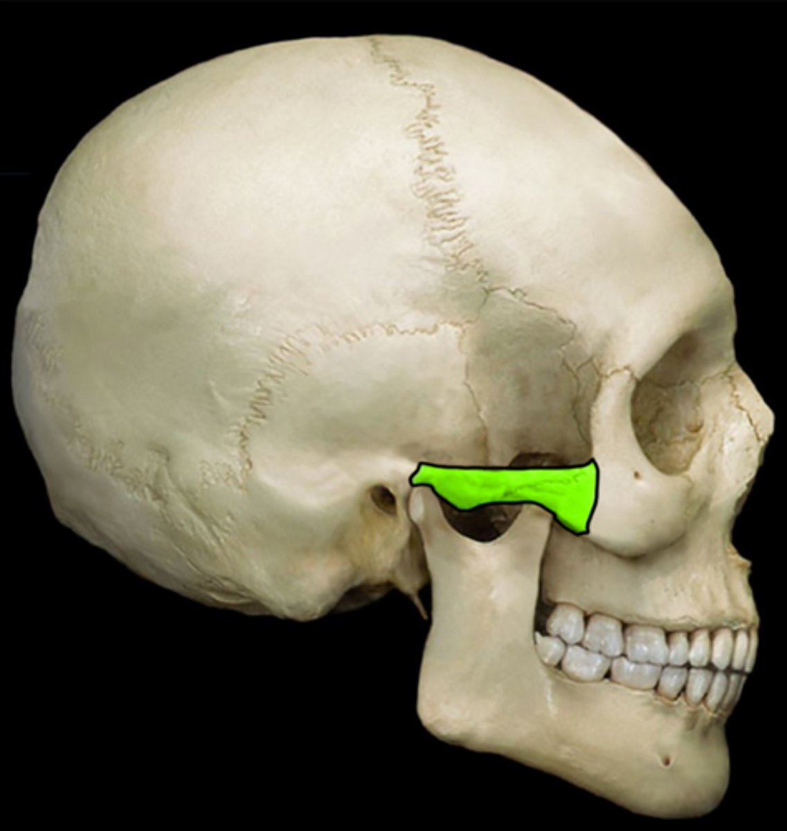 <p>formed by union of the zygomatic bone and the temporal bone</p>