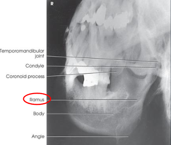 <ul><li><p>shows region of the mandible that was parallel with the IR: ramus, body, or symphysis</p></li><li><p>ramus and body:</p><ul><li><p>no overlap of the ramu sby opposite side of mandible</p></li><li><p>no elongation or foreshortening of ramus or body</p></li><li><p>no superimposition of the ramus by the cervivcal spine</p></li></ul></li><li><p>symphysis:</p><ul><li><p>no overlap of the mentum region by the opposite side of the mandible</p></li><li><p>no foreshortening of the mentum region</p></li></ul></li></ul><p></p>