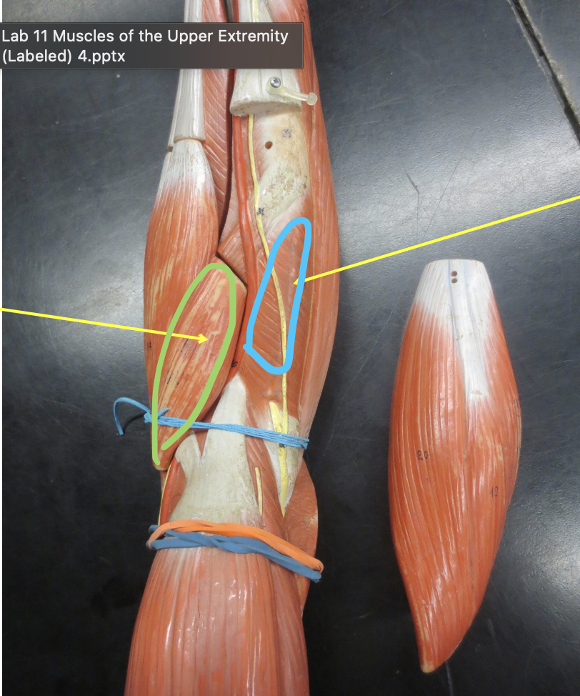 <p>Muscle in blue</p>