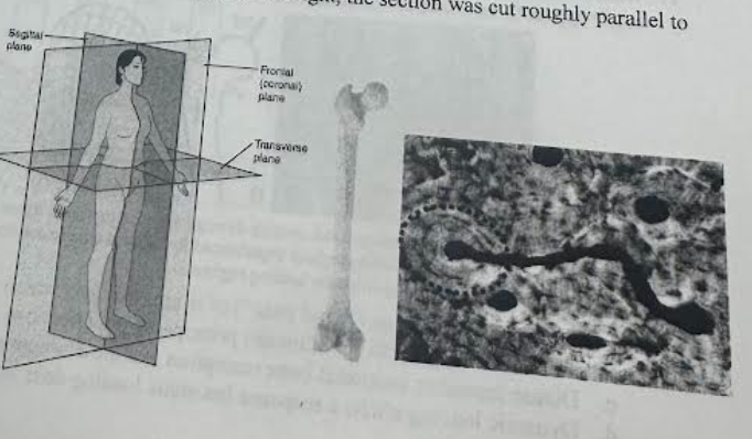 <p>Based on the femoral cortical bone microarchitecture at right, the section was cut roughly parallel to which plane?</p><p>a. Sagittal</p><p>b. Frontal</p><p>c. Transverse</p>