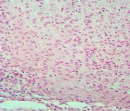 <ul><li><p>Gotas lipídicas escasas.</p></li><li><p>Citoplasma eosinófilo.</p></li><li><p>Gránulos de lipofusina.</p></li><li><p>Mitocondrias con crestas tubulares.</p></li><li><p>Secretan <span style="color: red"><strong>andrógenos suprarrenales (DHEA, DHEAS, androstenodiona)</strong></span><span style="color: #000000">.</span></p></li><li><p><span style="color: #000000">Son el 5% del total.</span></p></li></ul><p></p>
