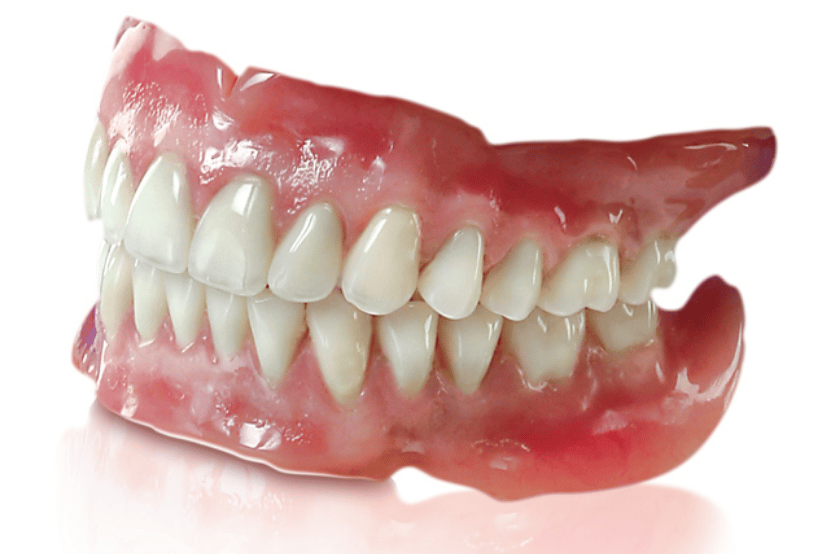 <p>A removable appliance that replaces all the teeth in an arch (upper or lower).</p>