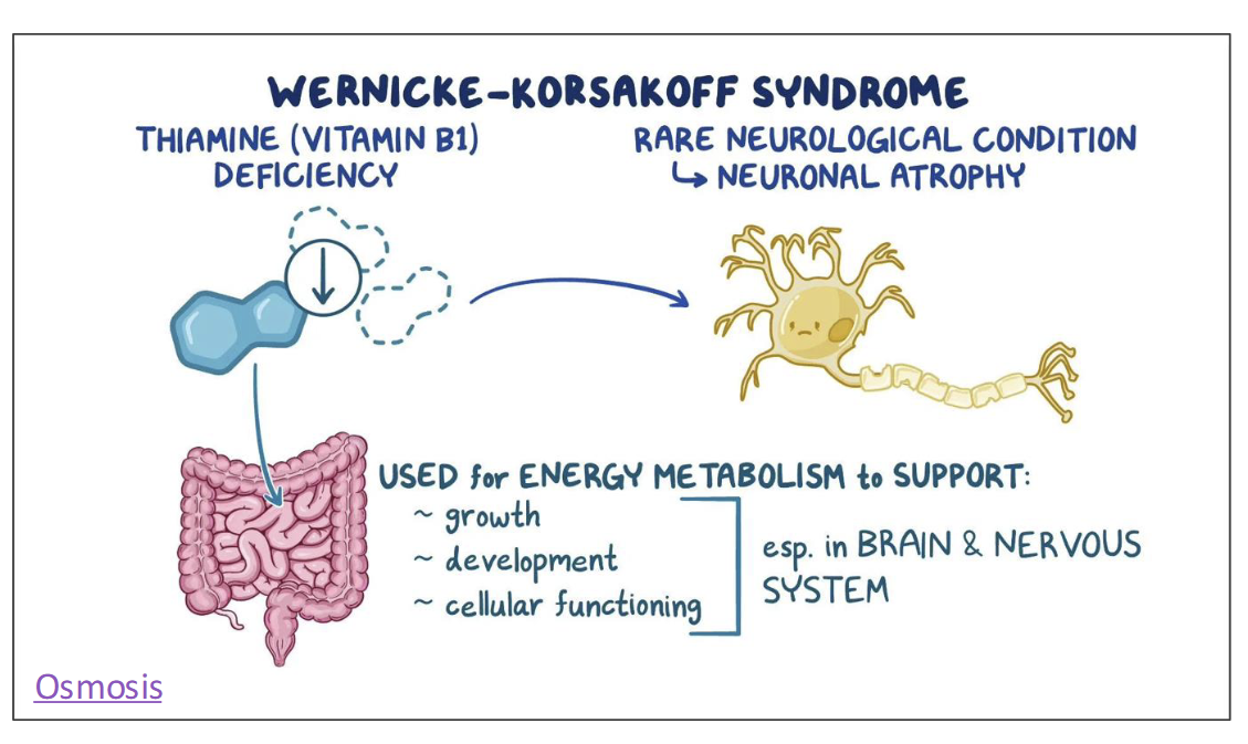 <p>Chronic alcohol consumption can lead to B1 deficiency, a condition called Wenicke-Korsakoff syndrome</p><ul><li><p>Alcohol impairs thiamin absorption & hasten thiamin excretion in the urine</p></li></ul><p></p>