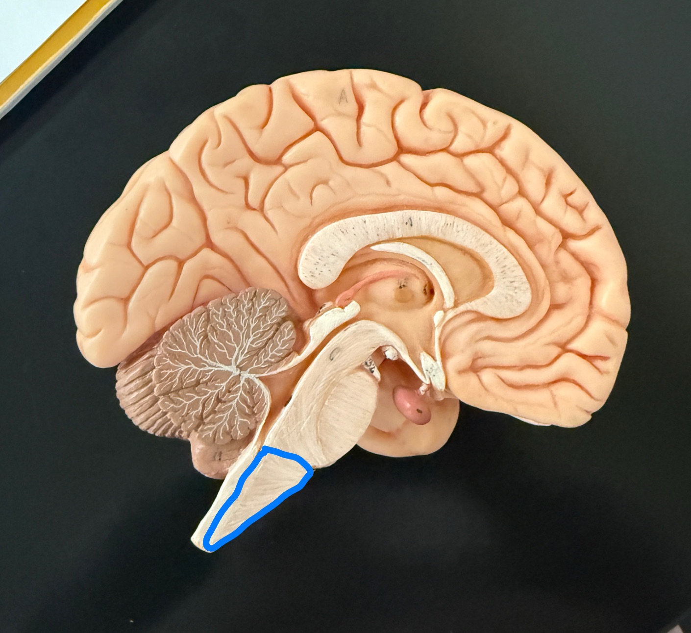 <p>What is outlined in blue on the brain model?</p>