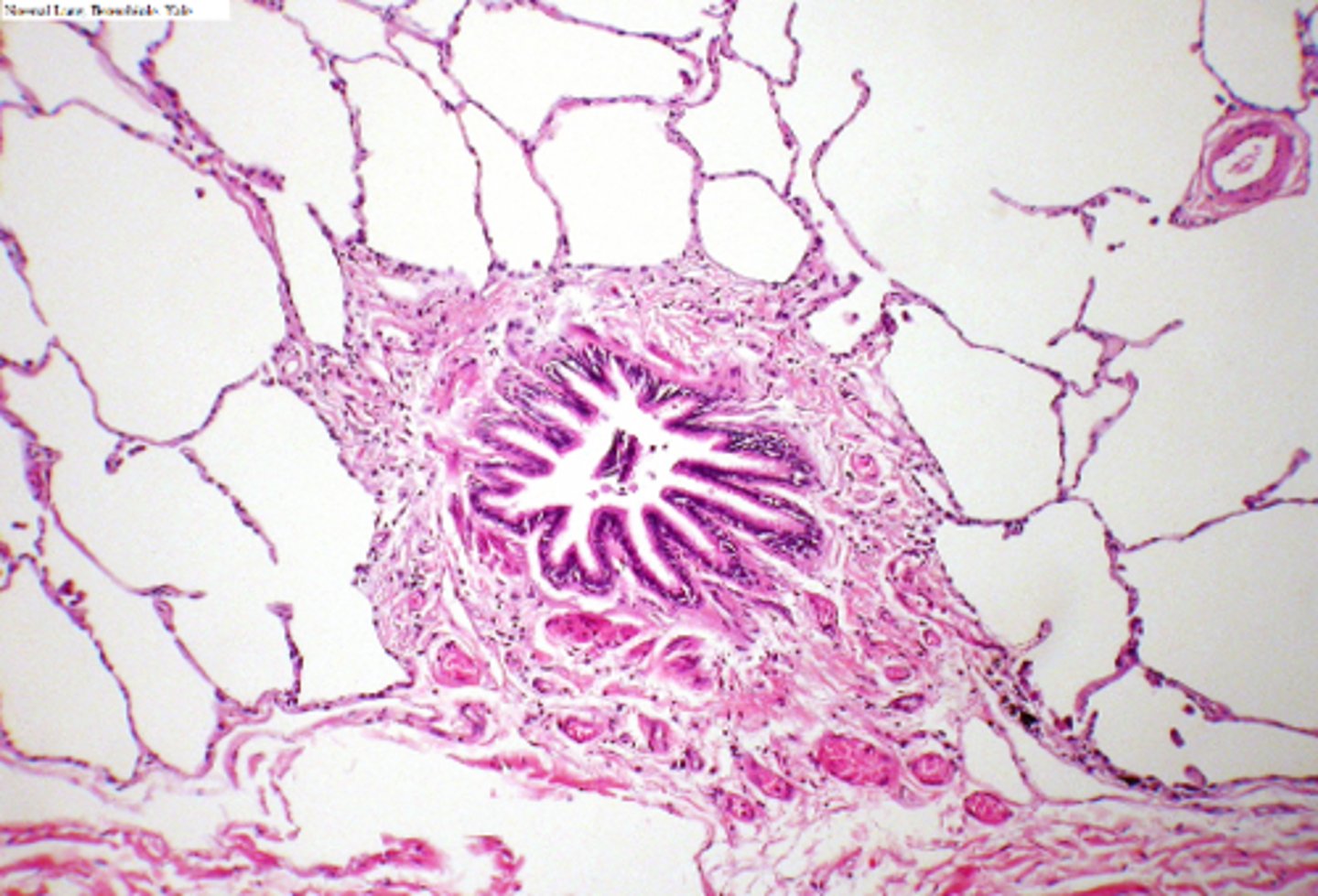 <p>ID the location of the slide:</p>