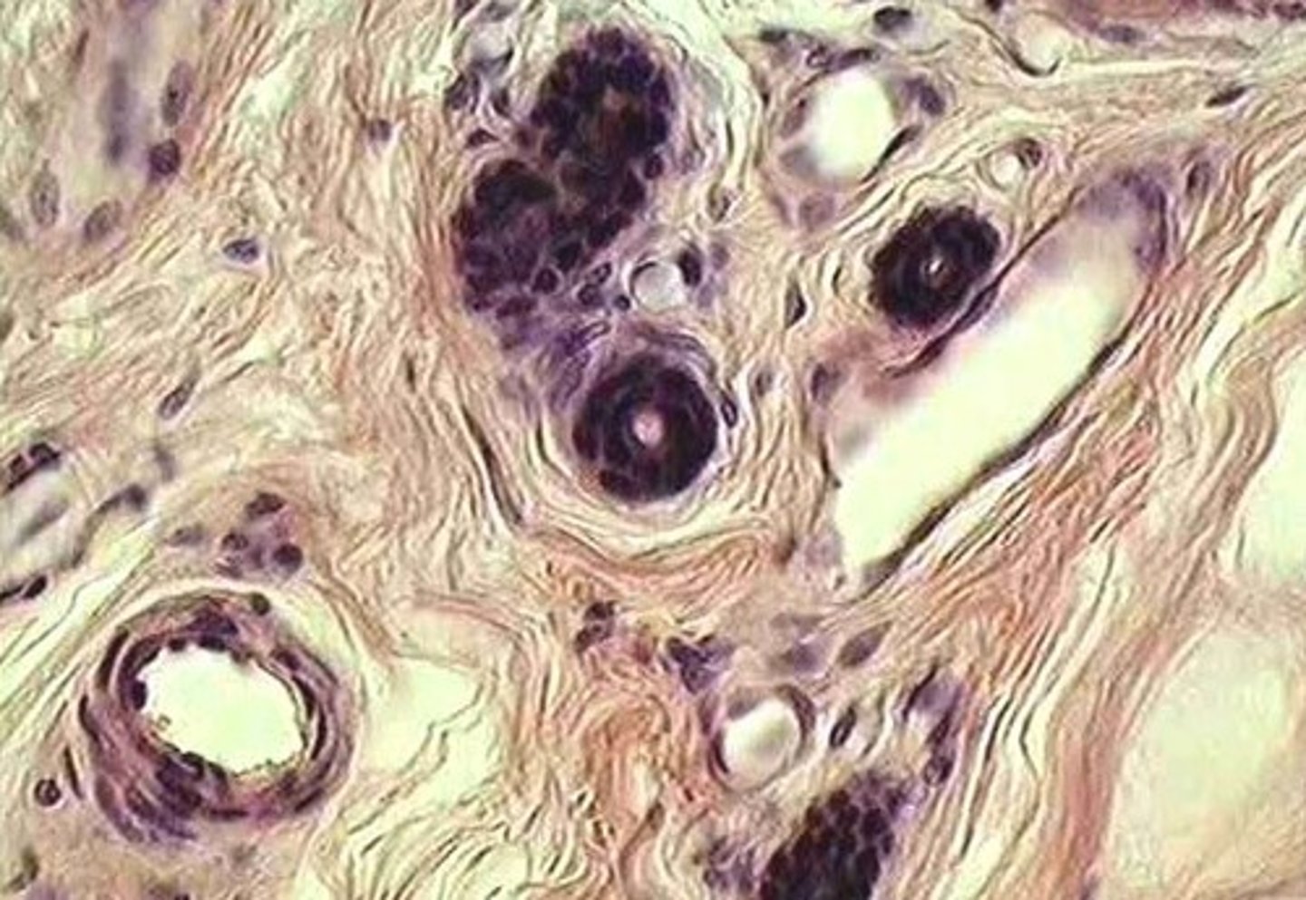 <p>walls of the ducts of sweat glands</p>