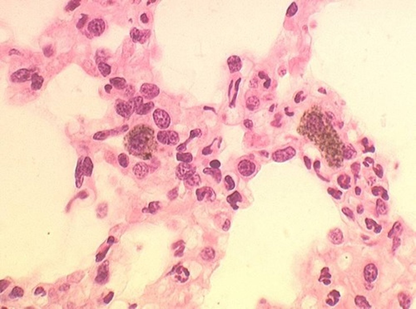 <p>Immune cells in alveoli that engulf pathogens.</p>