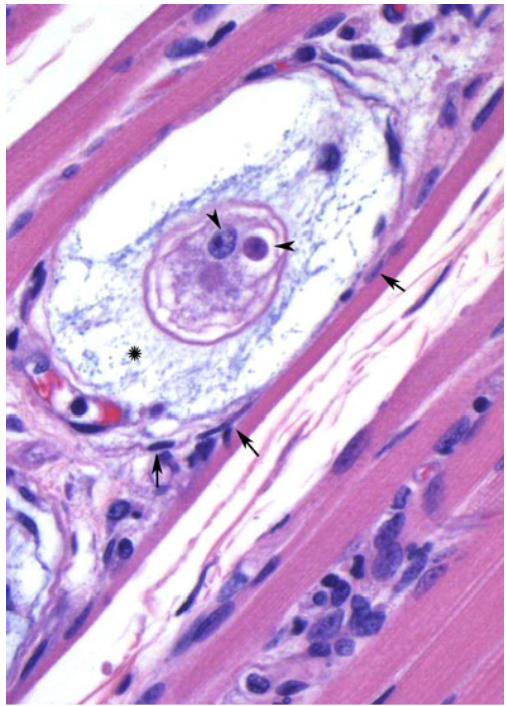 <p>what coccidia species is associated with this image?</p>