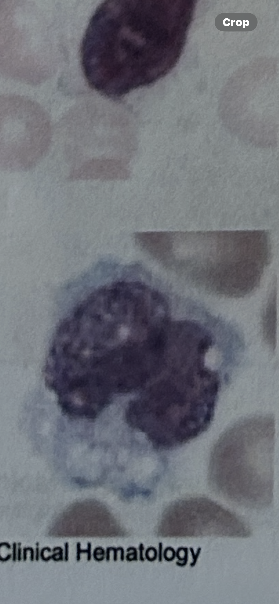 <p>WBC</p>