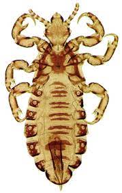 <p>Pediculidae</p><p></p><ul><li><p>Head about as long as thorax, but narrower than prothorax</p></li><li><p>Haustellate mouthparts</p></li><li><p>Antennae exposed</p></li><li><p>Head with eyes, but without ocular points</p></li><li><p>Abdomen longer than basal width</p></li><li><p>Middle and hind legs not stouter than front</p></li></ul>