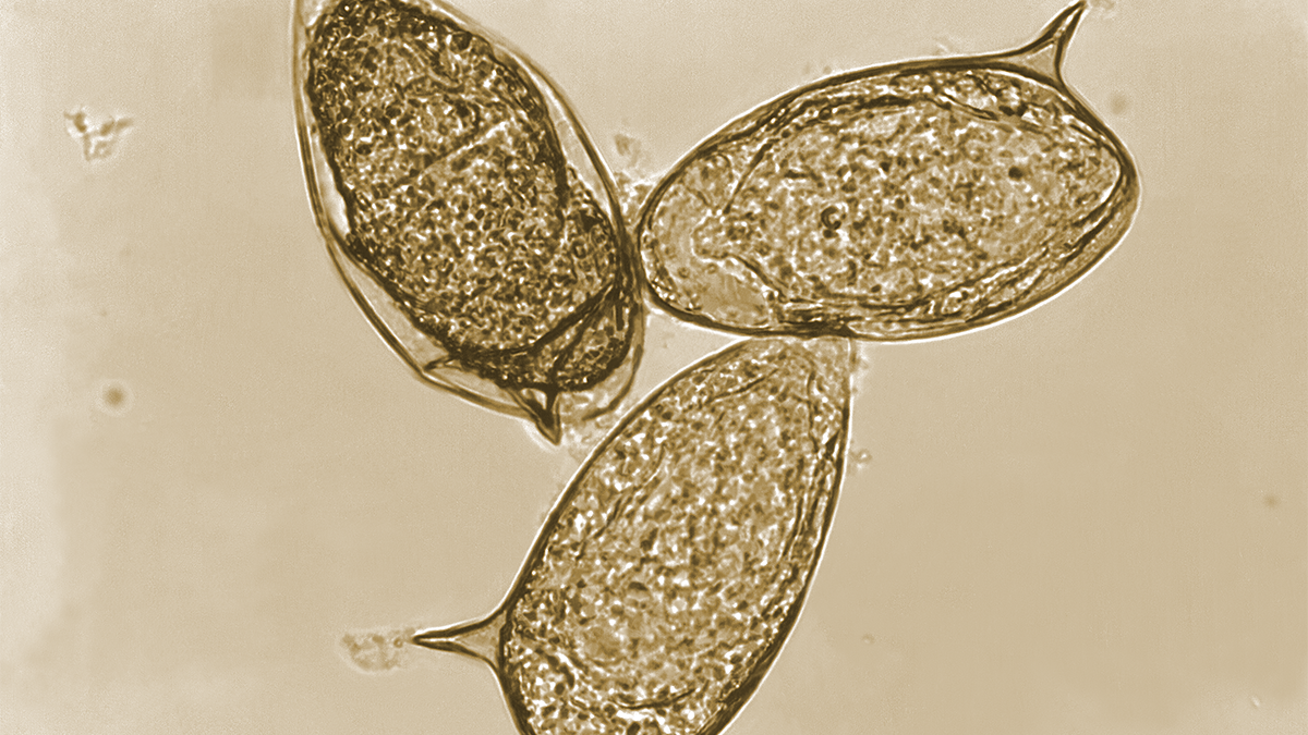<p>Schistosomiasis</p><p>Helminth (platyhelminth, flatworm) - fluke (trematode)</p><p>fecal-oral (and urinal/gastrointestinal) route</p><p>freshwater snails</p>