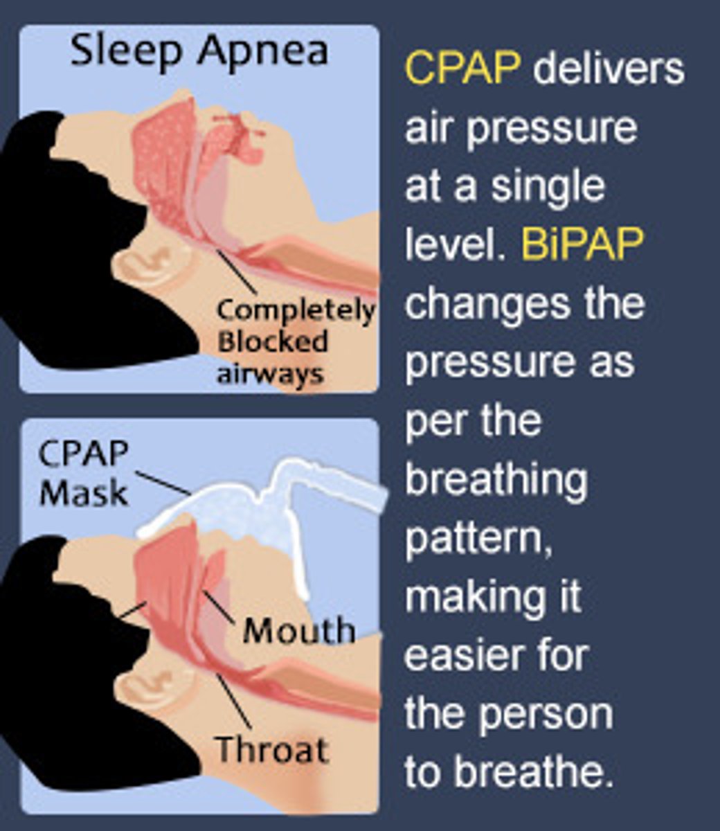 <p>continuous positive airway pressure (CPAP) - forces steady flow of pressurized air into nose/ mouth</p><p>mandibular repositioning device - removable device that physically moves the jaw forward</p><p>Inspire upper airway stimulation - implamted device that sends electrical signals to hypoglossal nerve</p>