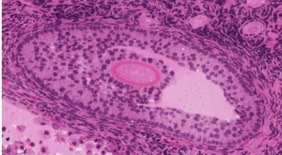 what type of follicle?