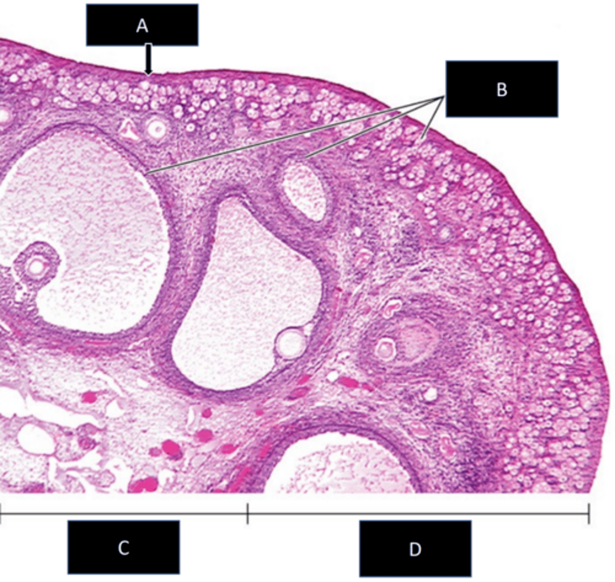 <p>a: epithelium</p>