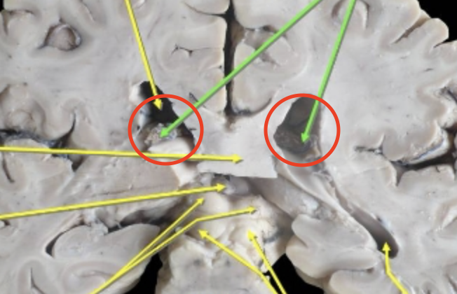 <p>Responsible for producing cerebrospinal fluid</p>