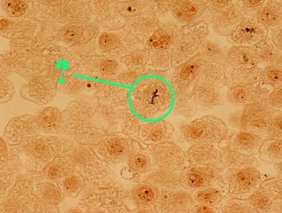 <p><span style="font-family: Lato Extended, Lato, Helvetica Neue, Helvetica, Arial, sans-serif">Identify the indicated phase of mitosis.</span></p>