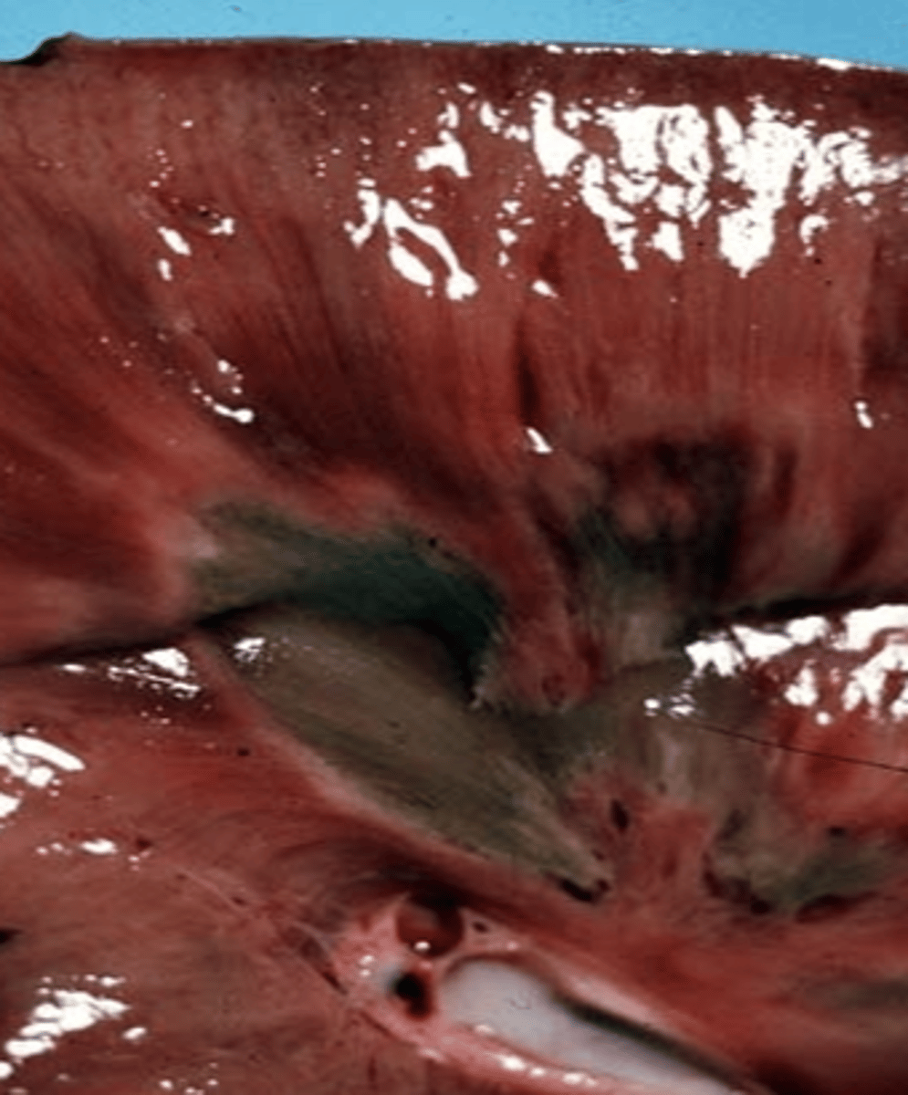 <p>This image is showing</p>