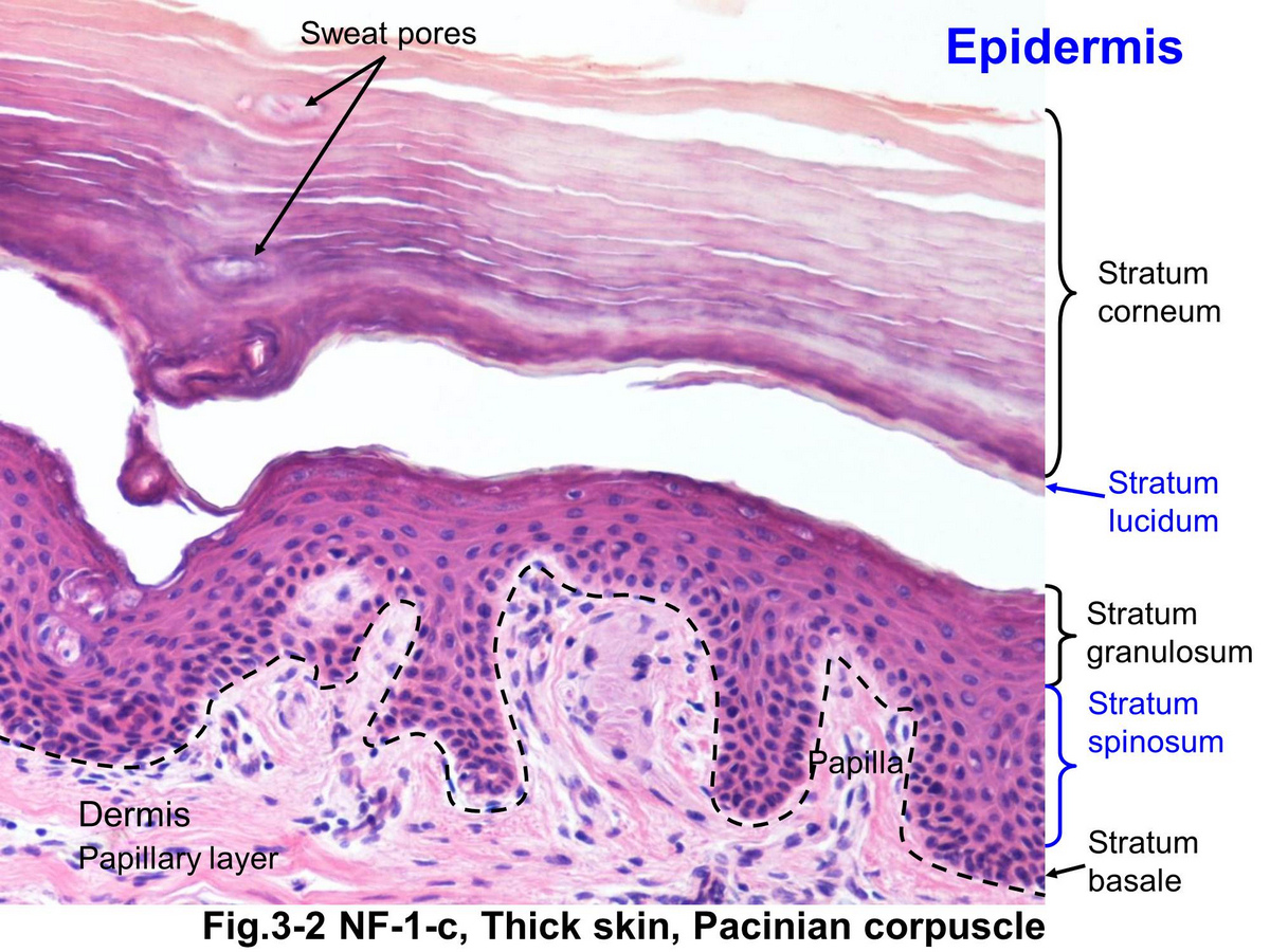 <p>thick layer of epidermis (darker than dermis because it is a thick layer of DEAD skin cells)</p><p></p>