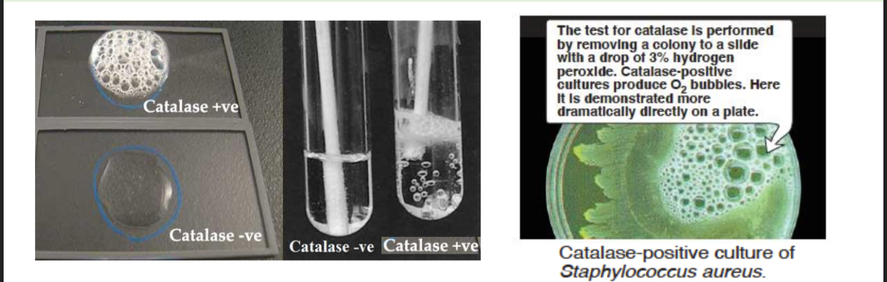 <p>Catalase Test</p>