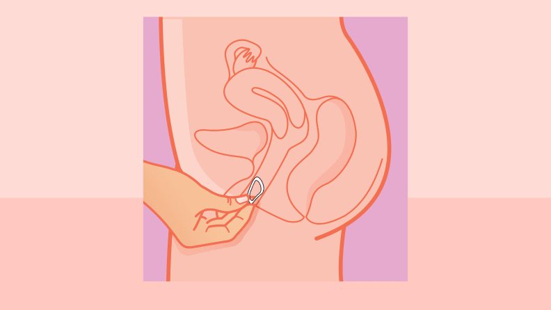 <p><strong>How long is the Vaginal Contraceptive kept inside? When is it taken out?</strong></p>