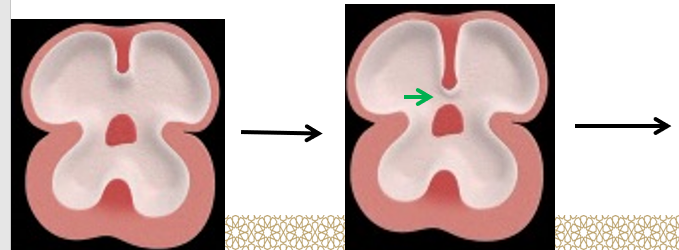 <p><u>Septum primum</u></p><ul><li><p>Grows from the _________ ______ towards the fusing AV _______, <strong>partially dividing the atrium </strong>into right and left halves.</p></li><li><p>This septum develops a large _______ called the _______ ______ (green arrow), between its<strong> lower free edge </strong>and the <strong>AV </strong>___________ _________.</p></li><li><p>This foramen _________ in size gradually until it __________ when the <strong>septum primum</strong> is completed by the ___________ _______ of the AV ______.</p></li><li><p>Before the foramen ______ disappears, another upper opening called the _______ ________ (blue arrow) appears.</p></li></ul>