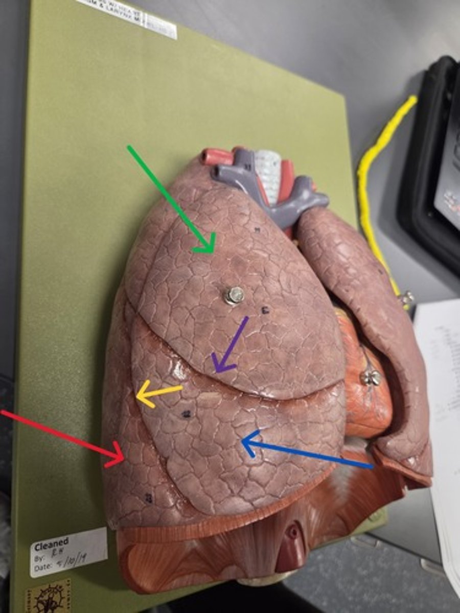 <p>What lung are all of the arrows pointing to?</p>