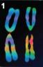 <p>Autosomes</p>
