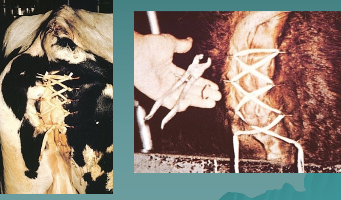 <p>what is this fixation method?</p>