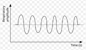 <p>Breaths are constant, deep, and fast with no pauses. The body is trying to blow off excess CO2</p><p></p><p>Cause: Metabolic acidosis </p><p></p><p>Fast + deep → fast + deep → fast + deep (no pause)</p>
